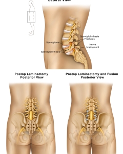 Spinal-Exhibits