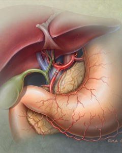 The Caterpillar™ Arterial Embolization Device (CAED) is a self-expanding, permanent medical implant designed to occlude peripheral blood vessels, such as in high-flow, peripheral arterial embolization. It features a unique design with opposing nitinol fibers for stability and a polyurethane/polyethylene membrane for rapid, precise occlusion. The Caterpillar™ Arterial Embolization Device (CAED) is a self-expanding, permanent medical implant designed to occlude peripheral blood vessels, such as in high-flow, peripheral arterial embolization. It features a unique design with opposing nitinol fibers for stability and a polyurethane/polyethylene membrane for rapid, precise occlusion.