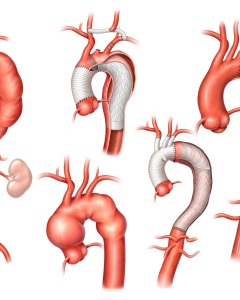 This is a sampling of various cardiothoracic anatomy and precedures. This is a sampling of various cardiothoracic anatomy and precedures.
