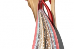 Drug eluting balloon in a peripheral artery
