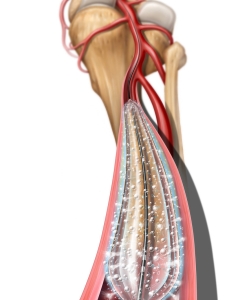 Drug eluting balloon in a peripheral artery