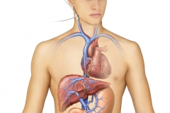 TIPS Catheter Placement